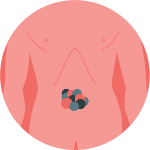 Strexit2 logo